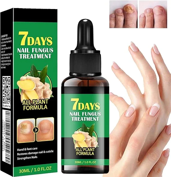 Tratamiento de hongos en las uñas de 7 días – Sérum Reparador de Uñas